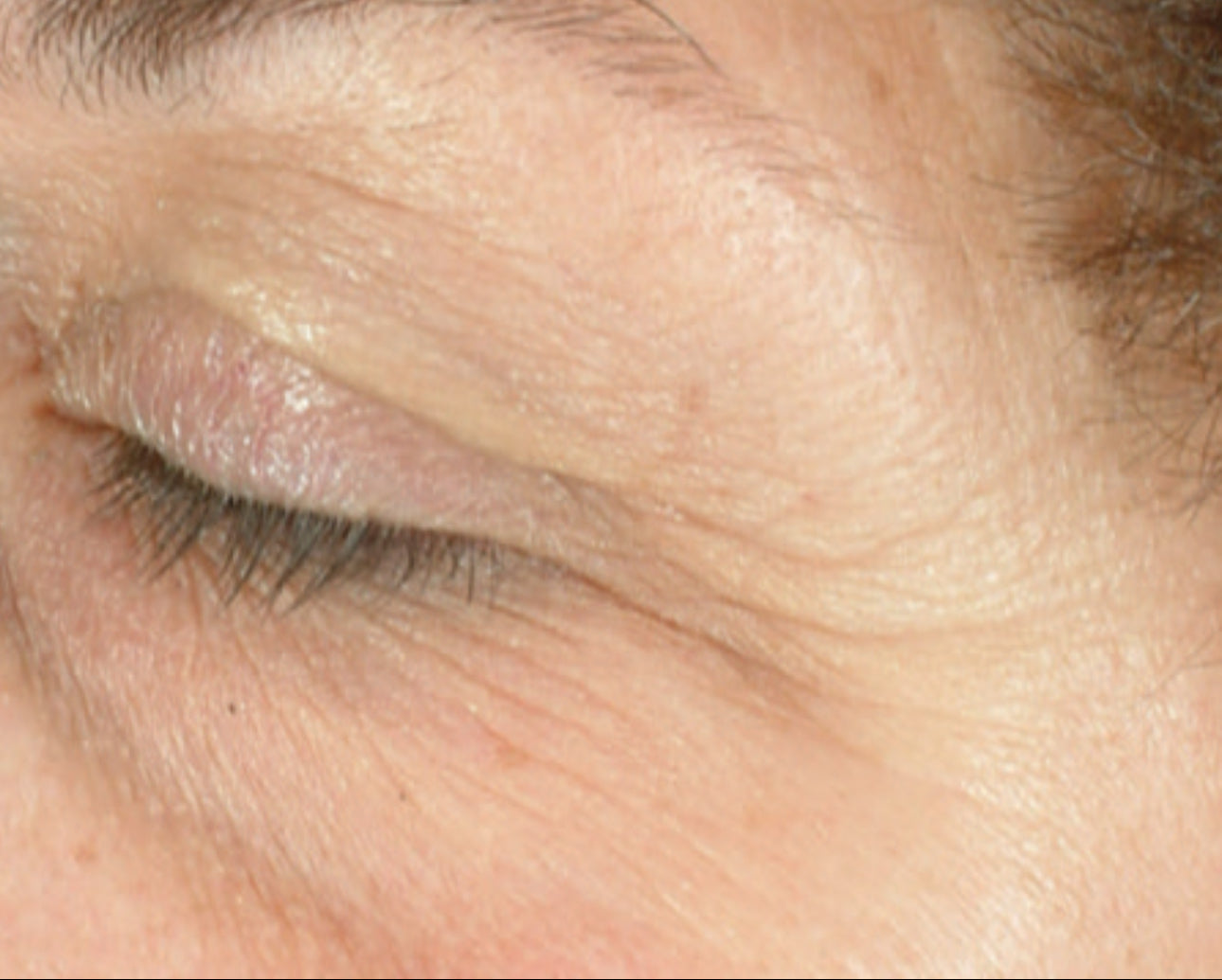 iS Clinical Youth Eye Complex