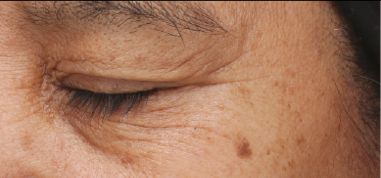 iS Clinical Youth Eye Complex