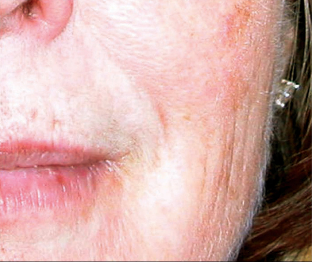 Youth Intensive Crème