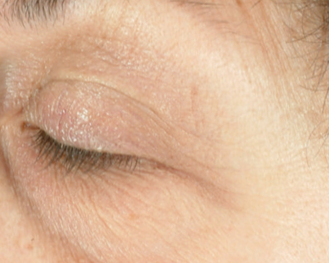 iS Clinical Youth Eye Complex