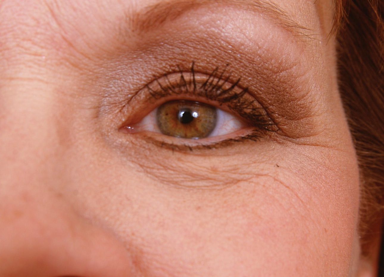 iS Clinical Youth Eye Complex