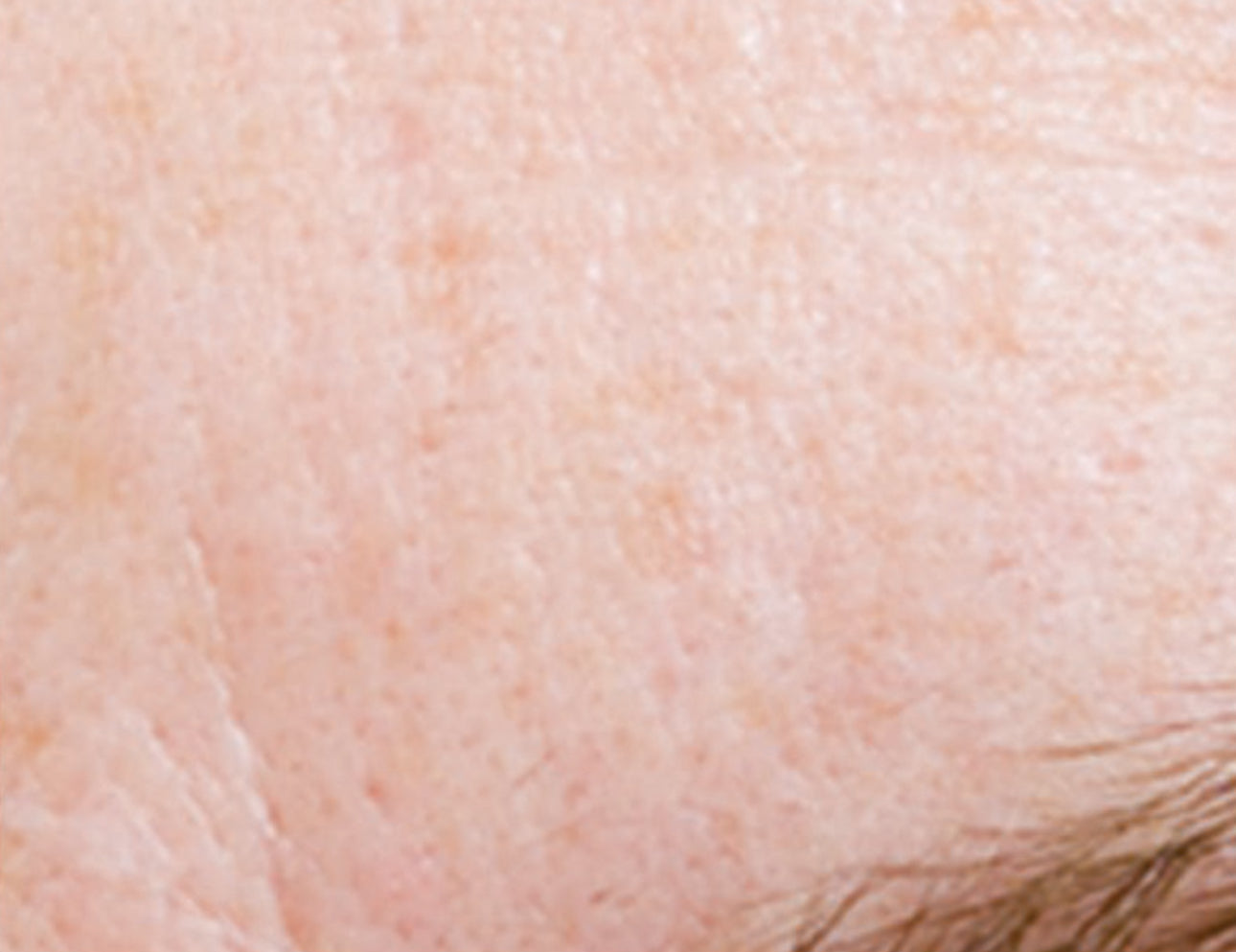 SUPER SERUM ADVANCE+® - Anti-Aging, Brightening, gegen Pickelmale, gegen Vernarbungen, Super-Antioxidant