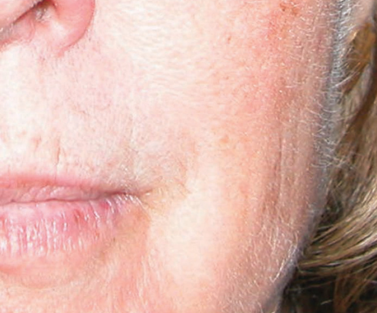 Youth Intensive Crème