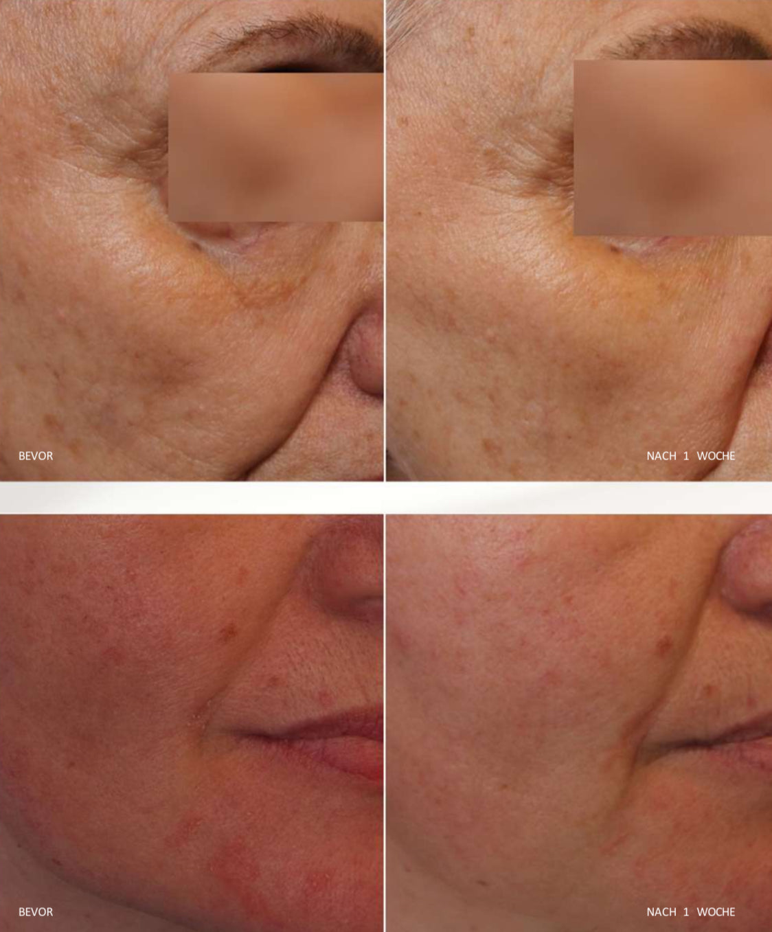 iS CLINICAL Daily Dynamic Hydrator