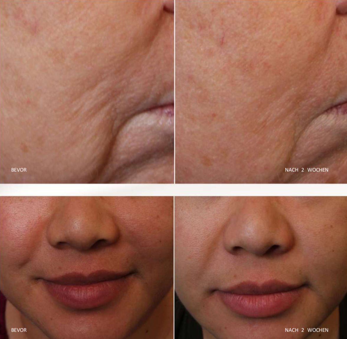 iS CLINICAL Daily Dynamic Hydrator